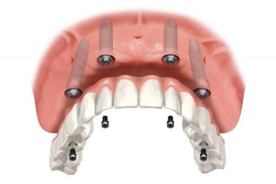 divide Curso de Especialização em Endodontia