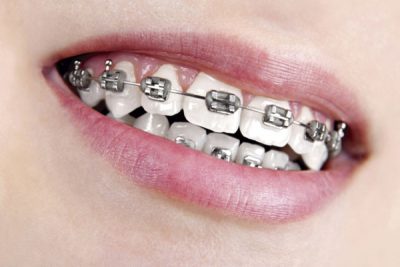 divide Especialização Prótese Dentária com ênfase em Prótese sobre Implantes e Estética